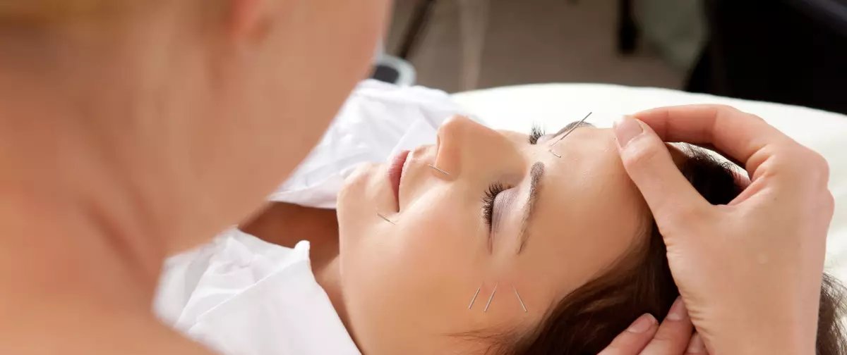 Acupuntura facial se consolida como alternativa natural para rejuvenescimento da pele - Imagem do artigo