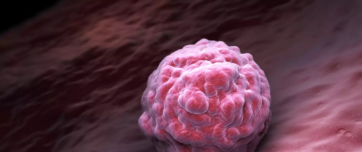 Brasil tem o 3º maior registro de doadores de medula óssea; saiba como se cadastrar - Imagem do artigo