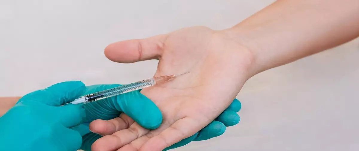 Suor excessivo nas mãos: entenda a hiperidrose palmar e as opções de tratamento - Imagem do artigo