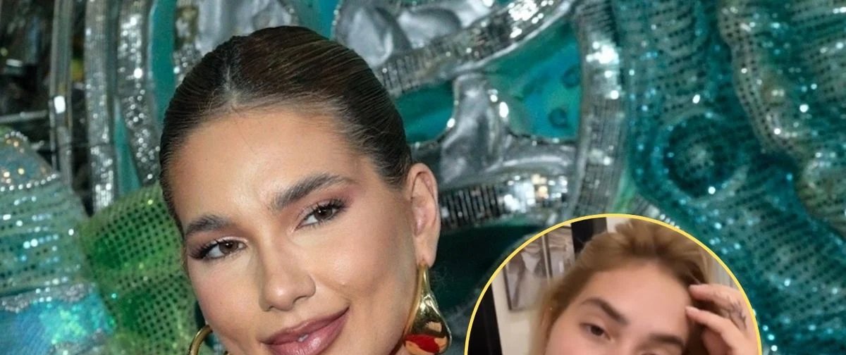 Médico detalha por que Virgínia Fonseca não pode comer chocolate e alerta que enxaqueca tende a se agravar - Imagem do artigo