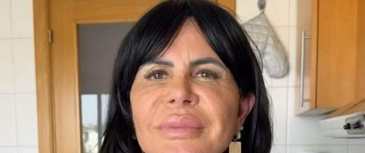 Gretchen apresenta novo visual após harmonização facial e recebe elogios do público - Imagem do artigo