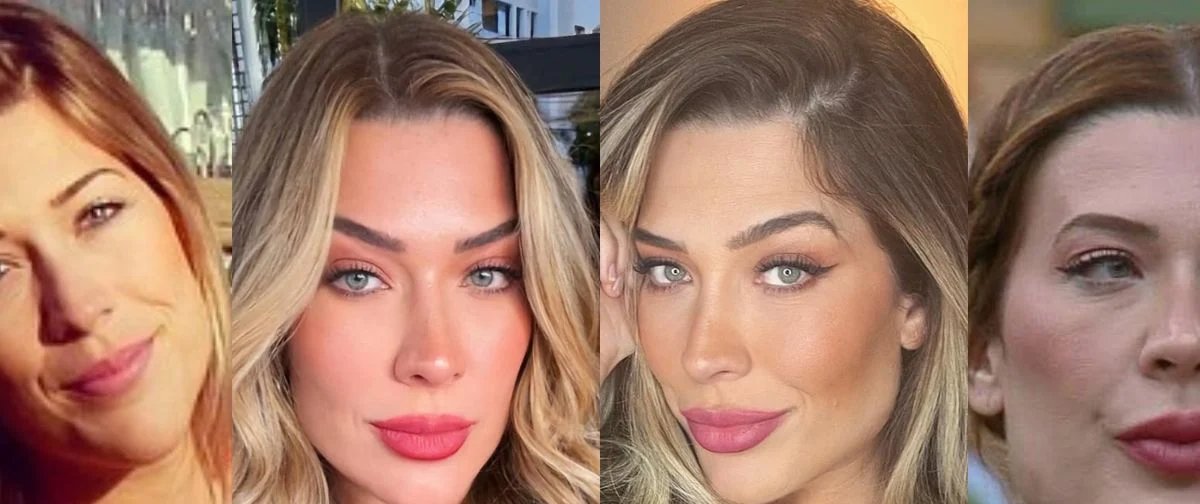 Harmonização facial de Renata Muller em “A Fazenda 17” vira assunto nas redes sociais - Imagem do artigo