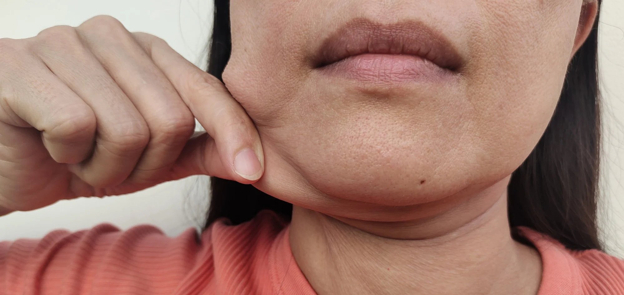 Dermatologista aponta quatro medidas simples para diminuir a papada no pescoço - Imagem do artigo