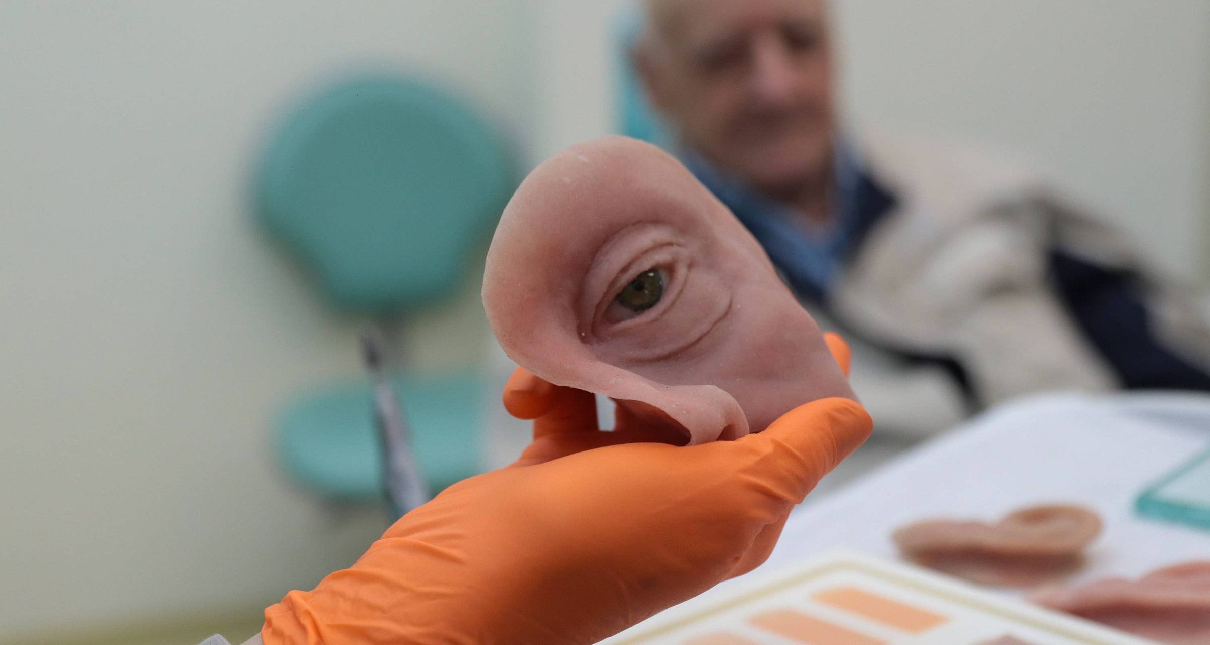 SUS no Paraná oferece próteses faciais que reproduzem tom de pele, olhos e até manchas - Imagem do artigo