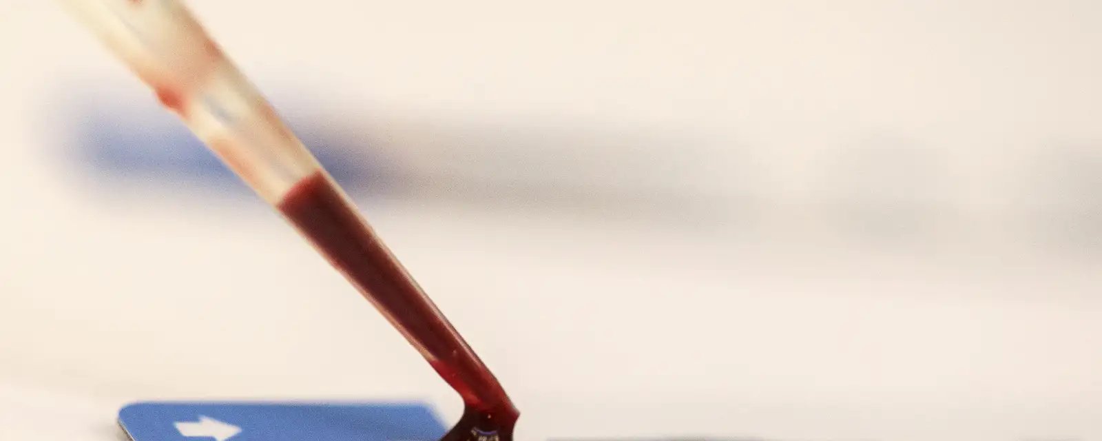 Fiocruz inicia estudo para ampliar uso da PrEP entre jovens de 15 a 24 anos - Imagem do artigo