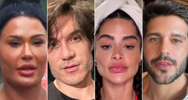 Gracyanne Barbosa decide retirar preenchimentos faciais para recuperar aparência natural - Imagem do artigo original