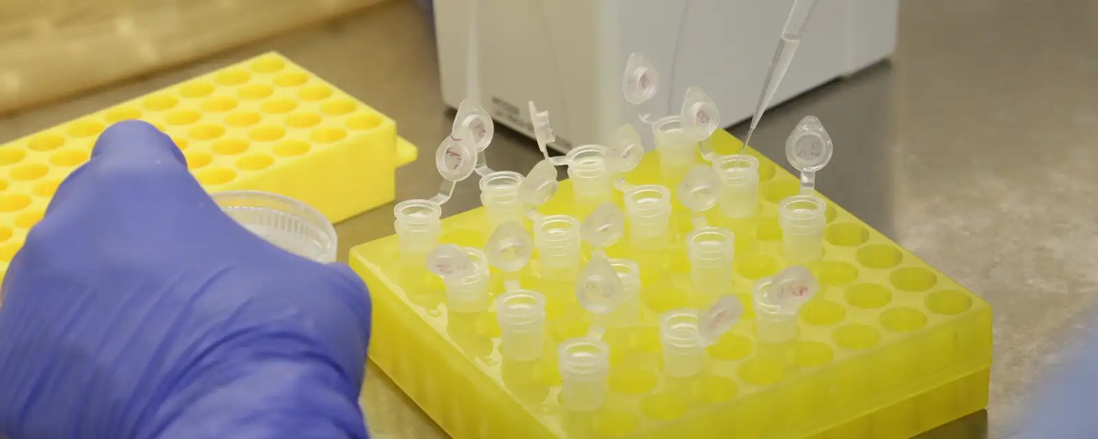 São Paulo registra segundo caso importado de sarampo em 2026 - Imagem do artigo