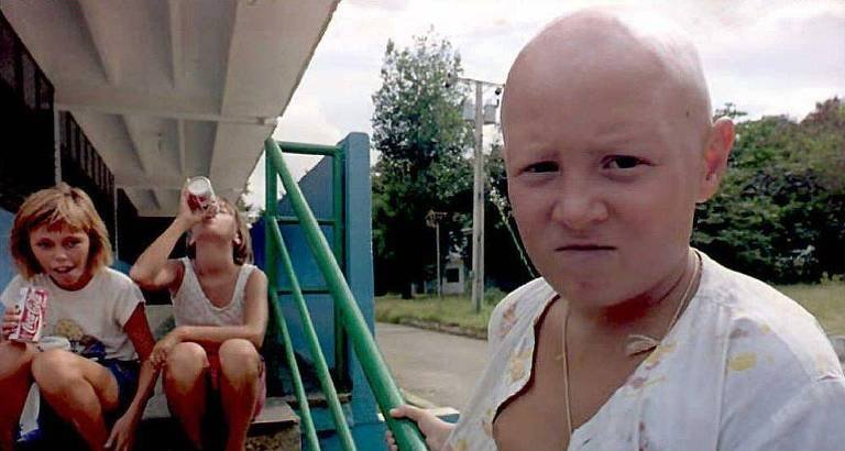 Cuba recebeu mais de 26 mil crianças afetadas por Tchernóbil para tratamento médico durante 21 anos - Imagem do artigo original