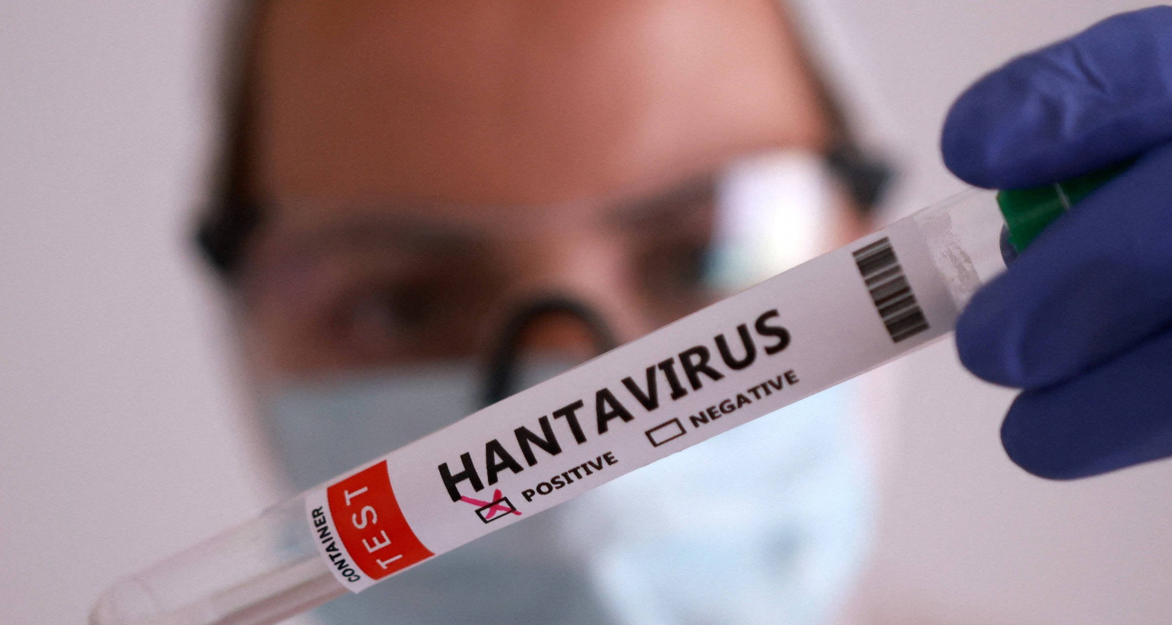 OMS confirma cinco casos de hantavírus em cruzeiro MV Hondius - Imagem do artigo