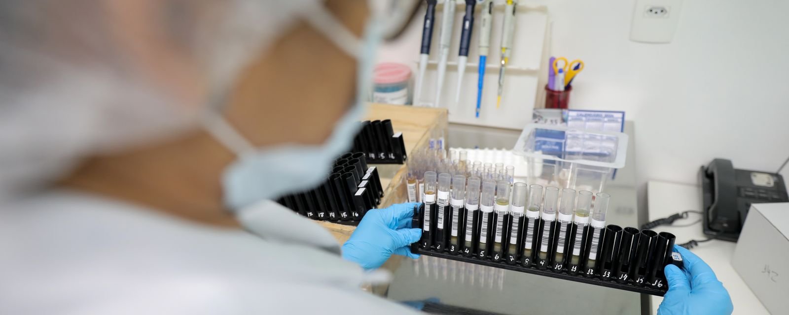 Fiocruz garante patente nos EUA para novo método de combate à malária resistente - Imagem do artigo